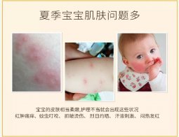 夏天来了,宝宝护肤品准备好了吗?